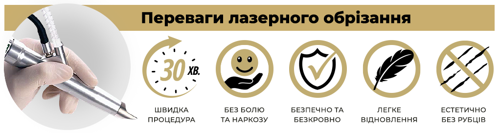 переваги-лазерного-обрізання.png переваги-лазерного-обрізання.png